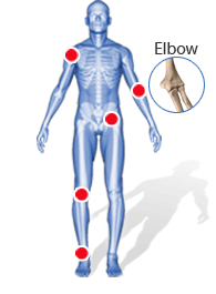Elbow - Patient Testimonials